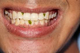 Liquide dentifrice pour hommes et femmes.